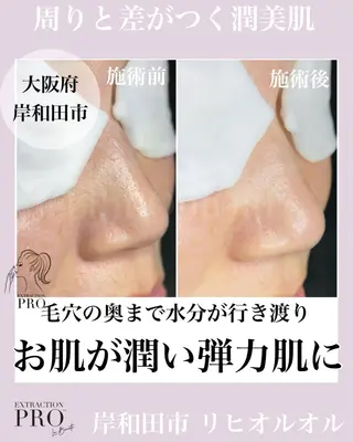 毛穴汚れ改善専門店/ 岸和田/リヒオルオルのエステ・リラクイメージ