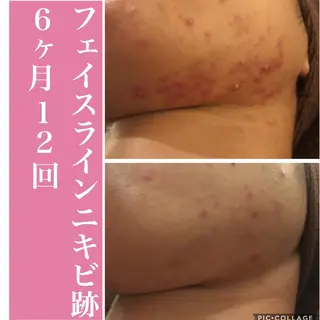 ミディアム カラー パーマ ヘアアレンジ メンズ キッズ ネイル マツエク・マツパ アイブロウ ニキビ・肌質改善専門 ♡人生が変わるサロンのエステ・リラクイメージ