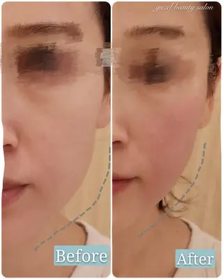 🅖🅤🅩🅔🅛 salonのエステ・リラクイメージ