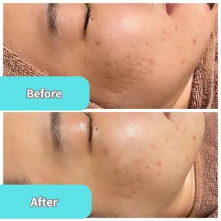 TWINKLE上尾店 Shimadaのエステ・リラクイメージ