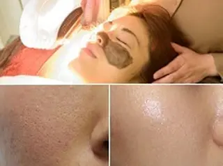 顔脱毛＆毛穴＆ニキビ 優良№1♪ヒロコ♪のエステ・リラクイメージ