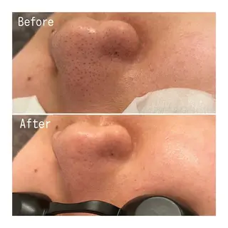 Remina clinical salon所属・ハイフ美肌専門 Remina.c.sのエステ・リラクイメージ