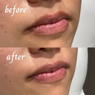 charm ai所属・高野 紗南のエステ・リラクイメージ