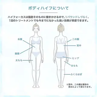 脱毛・ハイフ ・フェアリーのエステ・リラクイメージ