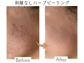 プライベートサロン Belle（ベル）のエステ・リラクイメージ