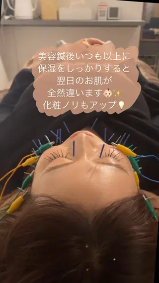 美容鍼/鍼灸 ここみ鍼灸院のエステ・リラクイメージ
