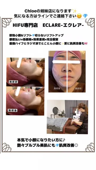 セミロング カラー パーマ ヘアアレンジ メンズ キッズ ネイル マツエク・マツパ Chloe-クロエ- 脱毛/フェイシャルのエステ・リラクイメージ