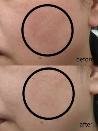 salon debijouのエステ・リラクイメージ