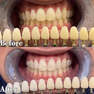 salon Bのマツエク・マツパデザイン