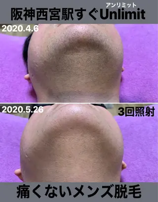 メンズ 脱毛＆エステサロン【アンリミット】所属・森谷 莉美のエステ・リラクイメージ