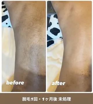 blue.【都度払い脱毛&フェイシャルサロン】所属・blue.💙【 脱毛&フェイシャル】のエステ・リラクイメージ