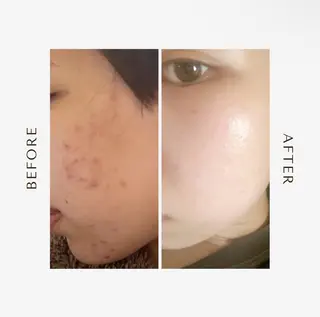 POLAあべのルシアス店所属・エステサロン れいなのエステ・リラクイメージ