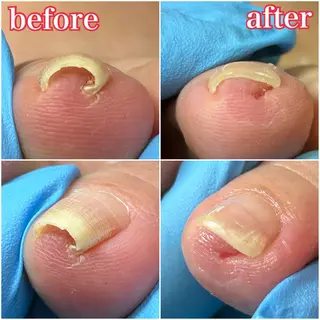 ネイル 巻き爪補正店　柏店所属・巻き爪補正店 柏店のその他イメージ