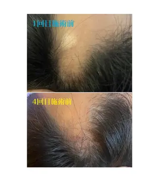 アロマ･美容鍼･カッ ピング「麗」鍼灸院のエステ・リラクイメージ