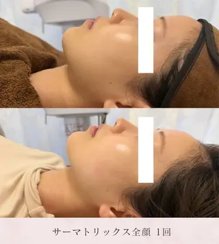 毛穴レス美肌へ🌿 看護師Abe🌼のエステ・リラクイメージ