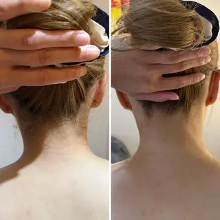 うなじ脱毛/美肌脱毛 LABELのエステ・リラクイメージ