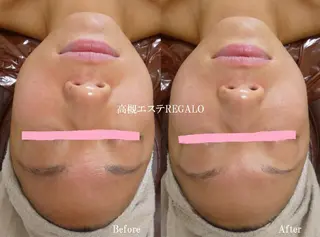 REGALO所属・矢野 さやかのエステ・リラクイメージ