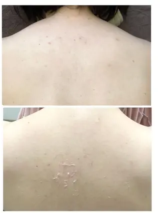 Belsia千歳烏山 ピーリング＆眉毛のエステ・リラクイメージ