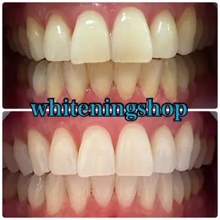 ホワイトニング ショップ吉祥寺店のエステ・リラクイメージ