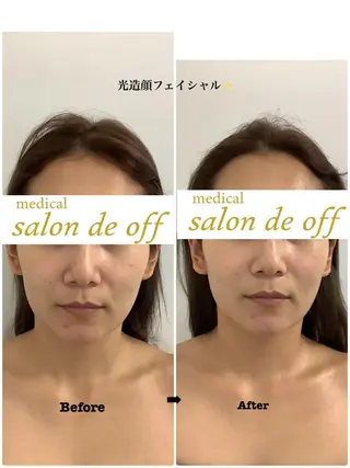 🩵Tatsumi Kana🩵のエステ・リラクイメージ