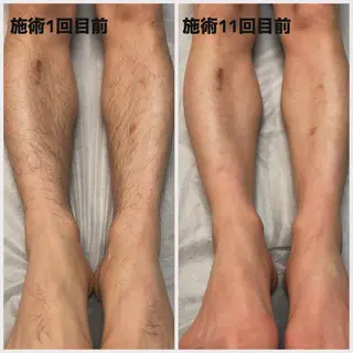 メンズ Esthetic Salon ECLIA所属・ECLIA 中田のエステ・リラクイメージ