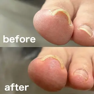 巻き爪フットケアサロンKotori所属・フットケアサロン Kotoriのその他イメージ