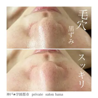 private salon hanaのエステ・リラクイメージ