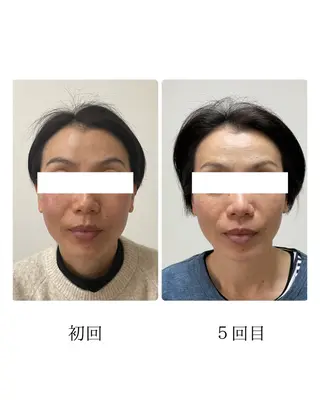 美容鍼灸サロン   colorier所属・美容鍼灸サロン colorierのエステ・リラクイメージ