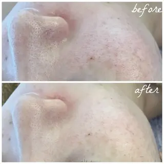 メンズ メナード岐阜市茜部 杉浦のエステ・リラクイメージ