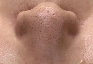 東京ビューティー 五反田店　nanaのエステ・リラクイメージ