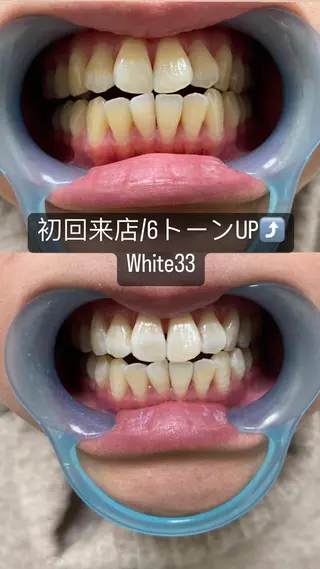 メンズ セルフホワイトニング White33大名のその他イメージ