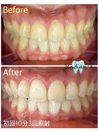 札幌ホワイトニング ラディアンス札幌駅店のその他イメージ