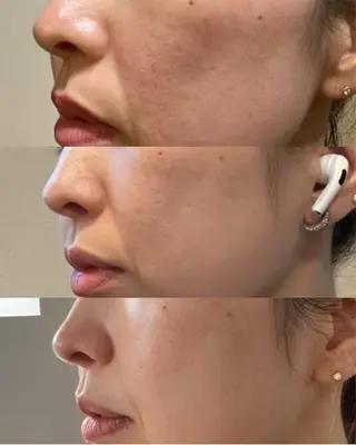 Blooming所属・LOUISE. ／肌質・頭皮のエステ・リラクイメージ