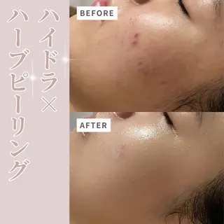 プライベートサロン Belle（ベル）のエステ・リラクイメージ