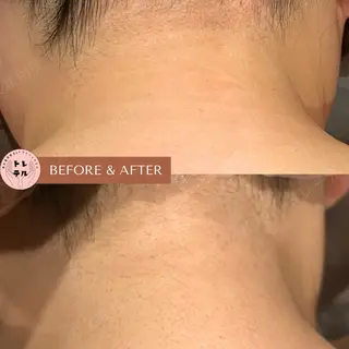 男女兼用脱毛＆ドライ ヘッドスパ トレテルのエステ・リラクイメージ