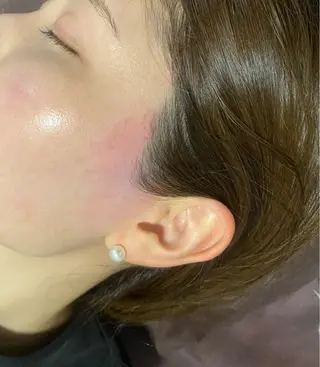 Morphome所属・【Morphome】 hinaのエステ・リラクイメージ