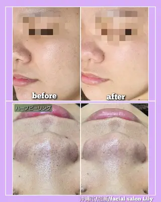 facial salon Lily所属・salon Lilyのエステ・リラクイメージ