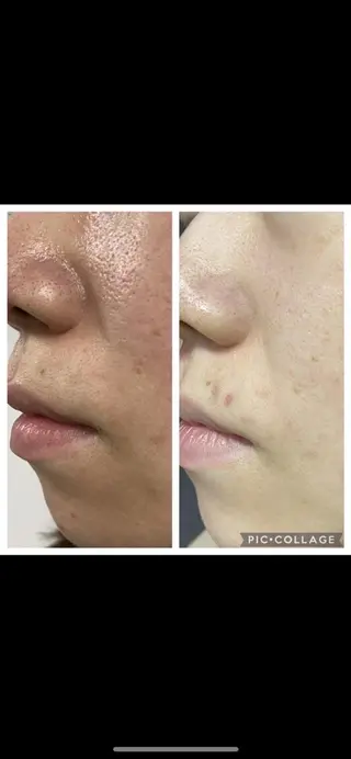 RinRin 星ヶ丘店のエステ・リラクイメージ