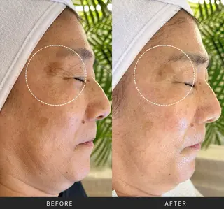 Lani Moon所属・⟡ 京都 小顔  ⊹ Lani Moonのエステ・リラクイメージ