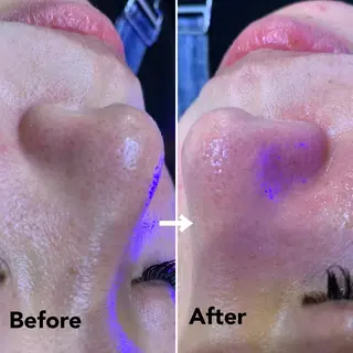 SESUNNY セサニー SEIRAのマツエク・マツパデザイン