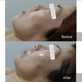 KatoreA カトレアのエステ・リラクイメージ