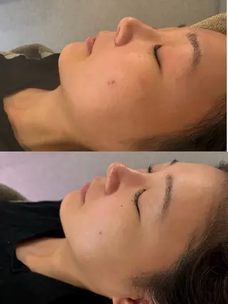 美容鍼灸サロン mahoroba院長のエステ・リラクイメージ