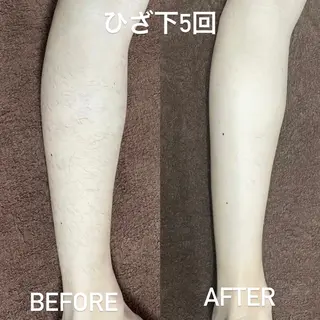 MINOA  大野城店所属・小林 千愛のエステ・リラクイメージ