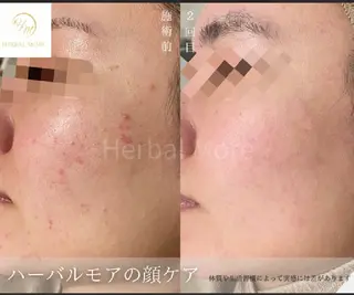 マツエク・マツパ hairsalon&eyelash Jill所属・Jill Erikaのエステ・リラクイメージ