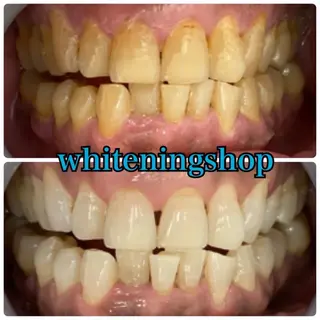 ホワイトニングショップ津店所属・ホワイトニング ショップ津店のその他イメージ