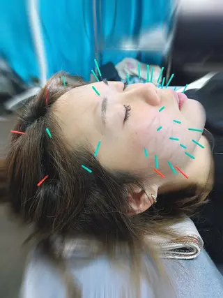 代々木美容鍼灸サロン"さくら"所属・🌸代々木美容鍼灸 サロン"さくら"🌸のエステ・リラクイメージ