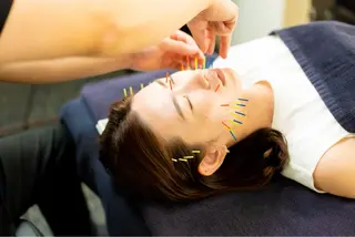 美容鍼・小顔矯正 FLOW 鍼灸整体院のその他イメージ