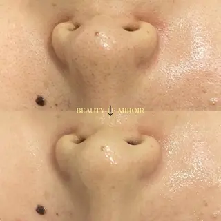 ビューティー ミロワールのエステ・リラクイメージ