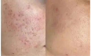 リールフェリス所属・大島 歌織のエステ・リラクイメージ