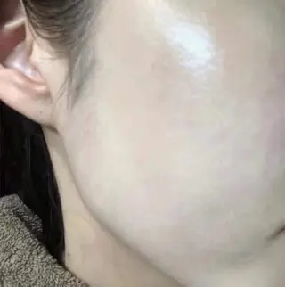 ネイル aliaハイフ&水光ジェットサロン所属・aliaハーブ水光店 エステティシャン募集のエステ・リラクイメージ